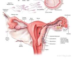 Scientific illustration of a sperm fertilizing a mature egg in the fallopian tube determining baby DNA